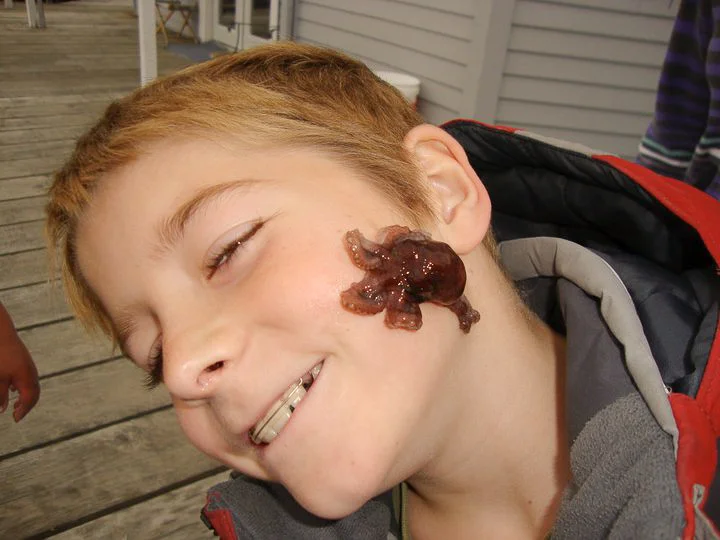 baby octopus on boy's face